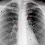 Diagnosedaten für e-Health-Anwendungen verfügbar machen.